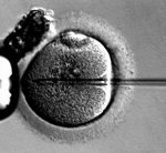 introduction du spermatozoïde dans l' ovocyte II pendant l'ICSI (Intracytoplasmic sperm injection)