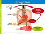 hypoGlycemie