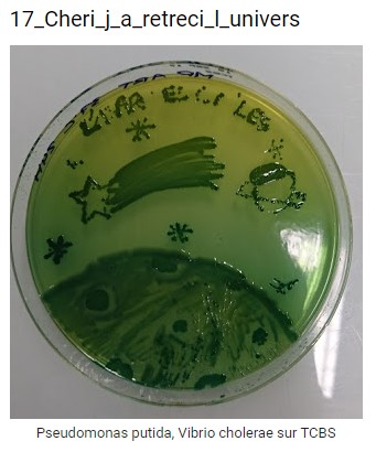 Pseudomonas putida, Vibrio cholerae sur TCBS