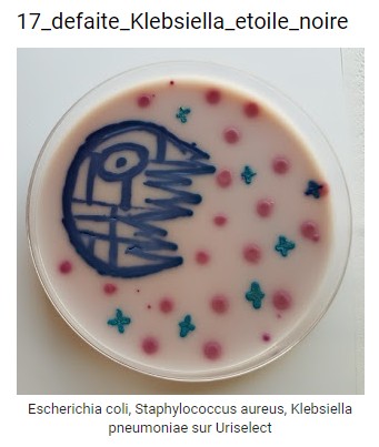 Escherichia coli, Staphylocoaque aureus, Klebsiella pneumoniae sur Uriselect