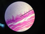 photographie d'une coupe de peau observée au microscope